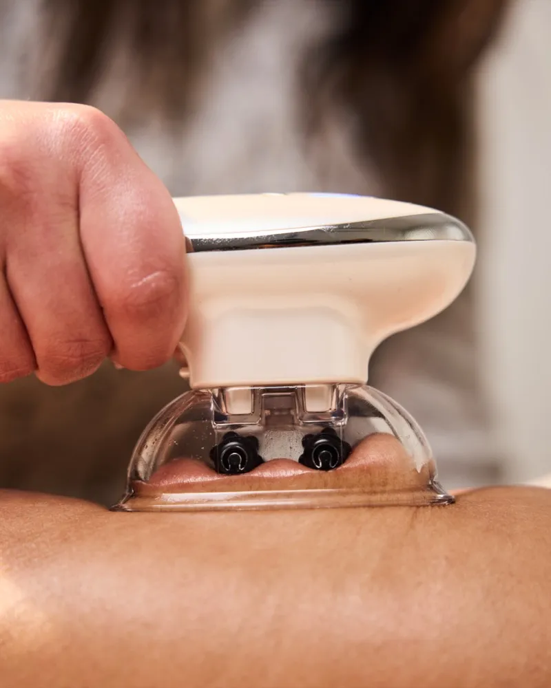 Cavitation body treatment at Synergy Clinic