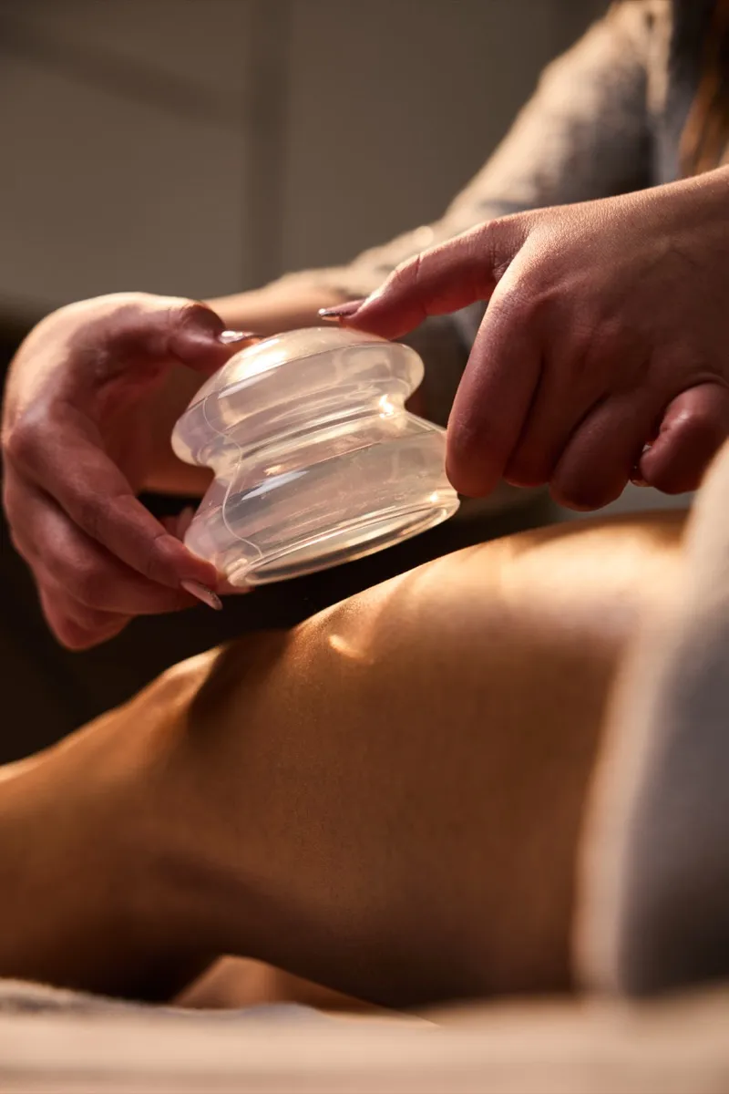 Silicone cupping body therapy at Synergy Clinic